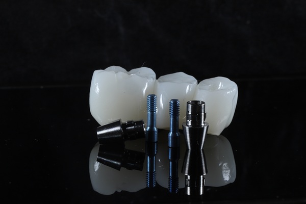 Replacing Upper Or Lower Set Of Teeth With All On