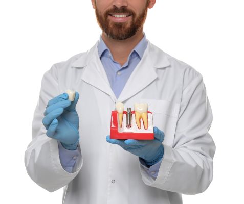 Dental Implants Step By Step: Procedure And Recovery