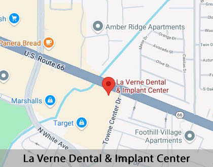 Map image for Interactive Periodontal Probing in La Verne, CA